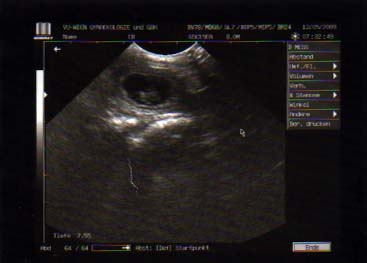 Ein kleiner B-Welpe im Ultraschall am 26.Tag:-)